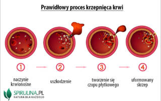 Zaburzenia krzepnięcia krwi