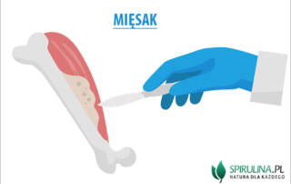 Mięsak