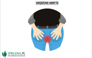 Swędzenie odbytu