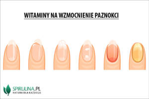 Witaminy na wzmocnienie paznokci