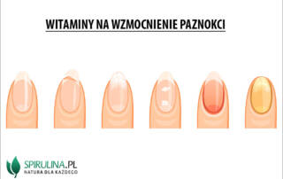 Witaminy na wzmocnienie paznokci