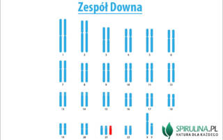 Zespół downa