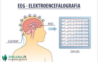 EEG (Elektorencefalografia)