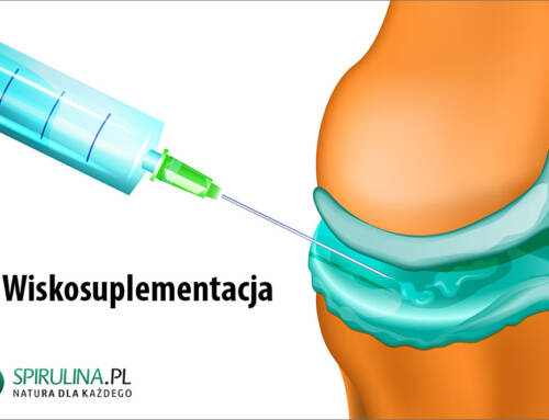 Wiskosuplementacja