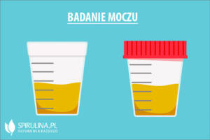 Badanie moczu