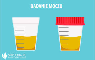 Badanie moczu