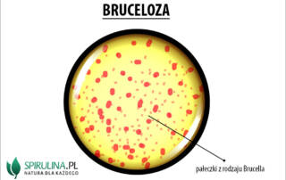 Bruceloza