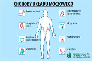 Choroby układu moczowego