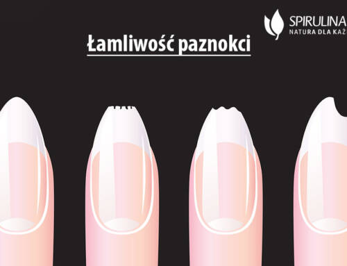 Łamliwość paznokci