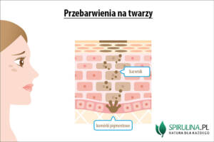 Przebarwienia na twarzy