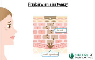 Przebarwienia na twarzy