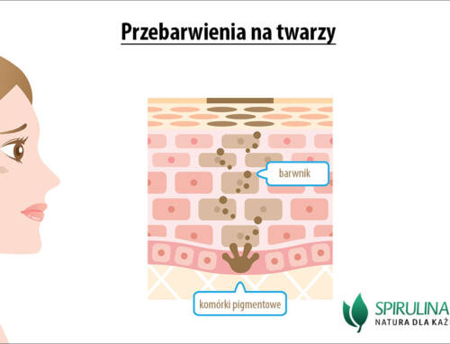 Przebarwienia na twarzy