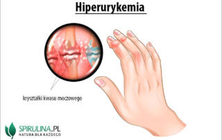 Hiperurykemia