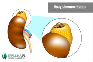 Guzy chromochłonne