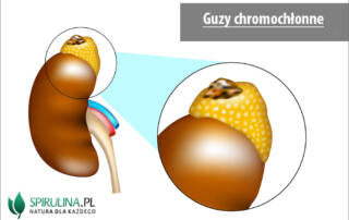 Guzy chromochłonne