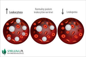 Leukocytoza