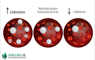 Leukocytoza