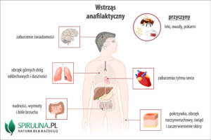 Wstrząs anafilaktyczny