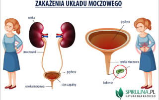 Zakażenia układu moczowego