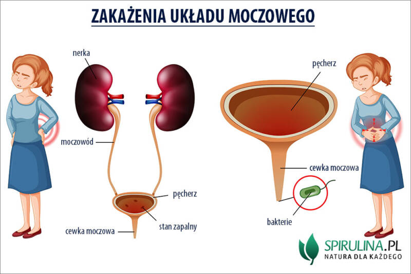 Dializę Wykonuje Się Gdy Zaburzone Jest Funkcjonowanie Zakażenia układu moczowego - algi Spirulina i Chlorella