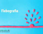 Flebografia