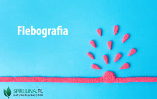 Flebografia