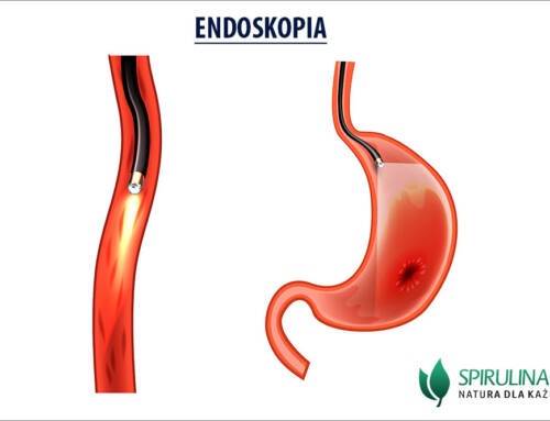 Endoskopia