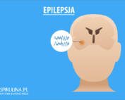 Epilepsja