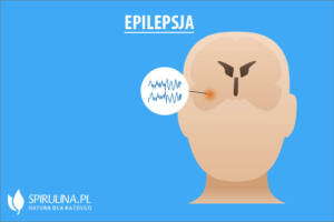 Epilepsja