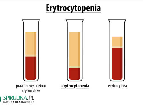 Erytrocytopenia