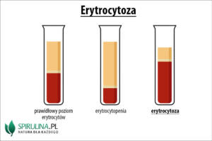 Erytrocytoza