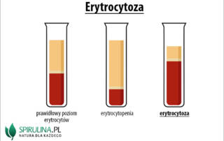 Erytrocytoza