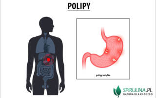 Polipy