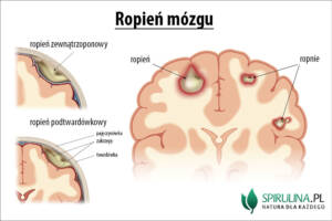 Ropień mózgu