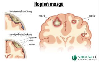 Ropień mózgu