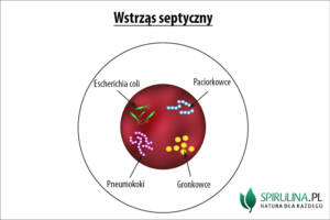 Wstrząs septyczny