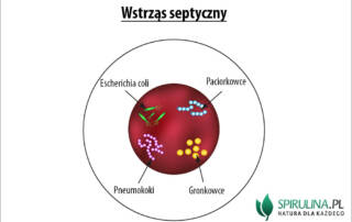 Wstrząs septyczny