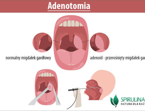 Adenotomia