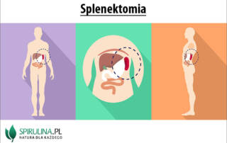 Splenektomia