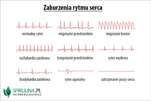 Zaburzenia rytmu serca