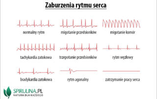 Zaburzenia rytmu serca