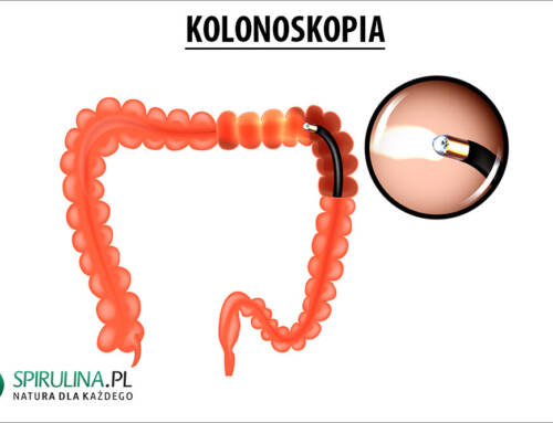 Kolonoskopia