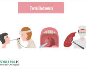 Tonsillotomia