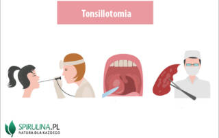 Tonsillotomia