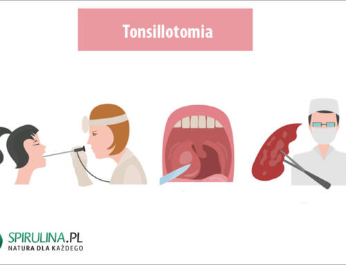Tonsillotomia