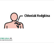 Chłoniak Hodgkina