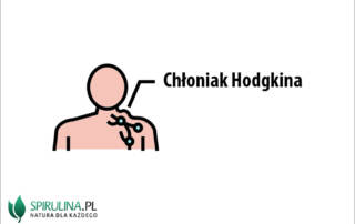 Chłoniak Hodgkina