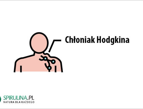 Chłoniak Hodgkina