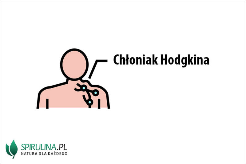Chłoniak Hodgkina - algi Spirulina i Chlorella