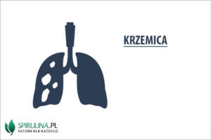 Krzemica